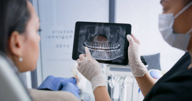 Licensed Tooth Extraction service in Springfield, SD - Smile Center Dentistry